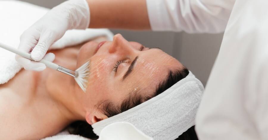 At-Home Peels: How Do They Compare With Professional Treatments?